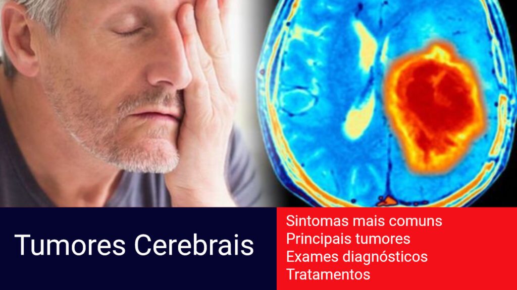 Tumores cerebrais